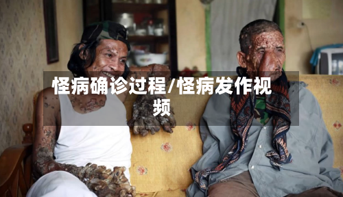 怪病确诊过程/怪病发作视频