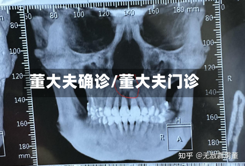 董大夫确诊/董大夫门诊-第3张图片
