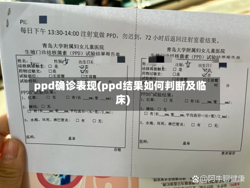 ppd确诊表现(ppd结果如何判断及临床)-第2张图片