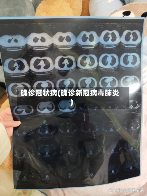 确诊冠状病(确诊新冠病毒肺炎)