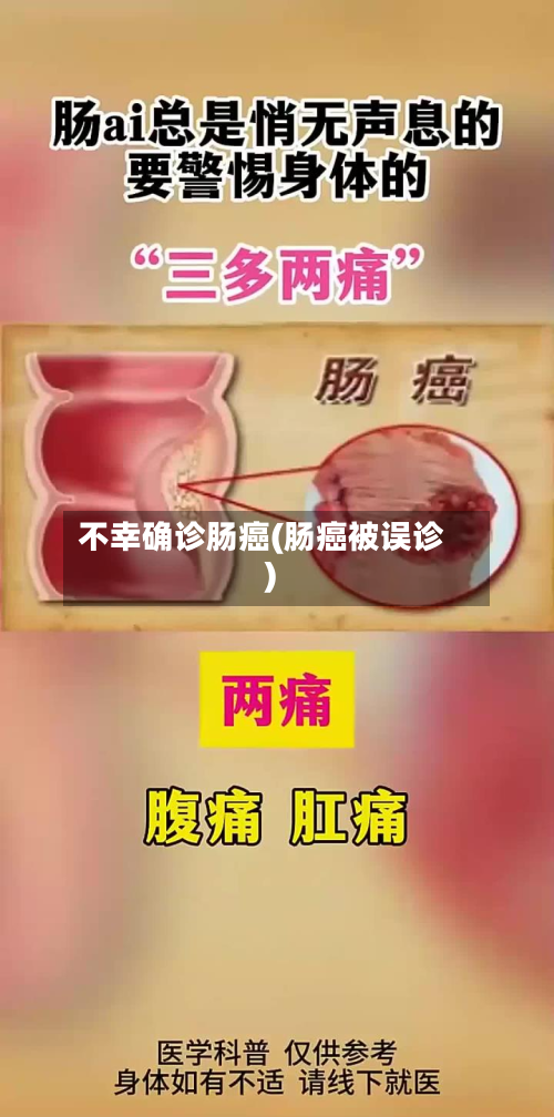 不幸确诊肠癌(肠癌被误诊)-第3张图片