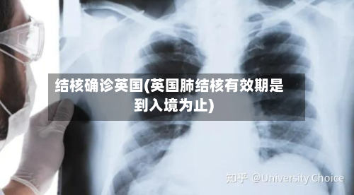 结核确诊英国(英国肺结核有效期是到入境为止)
