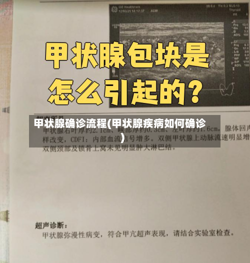 甲状腺确诊流程(甲状腺疾病如何确诊)-第3张图片