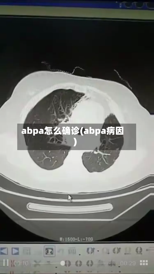 abpa怎么确诊(abpa病因)