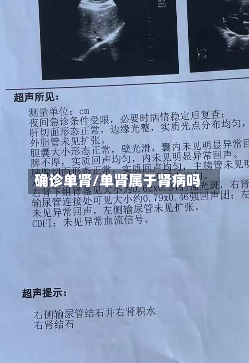 确诊单肾/单肾属于肾病吗-第2张图片