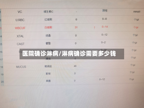 医院确诊淋病/淋病确诊需要多少钱