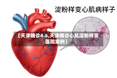 【天津确诊4.6,天津确诊心肌淀粉样变医院案例】