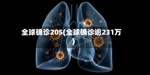 全球确诊205(全球确诊逾231万)-第3张图片