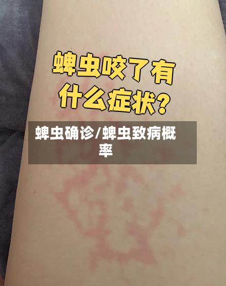 蜱虫确诊/蜱虫致病概率