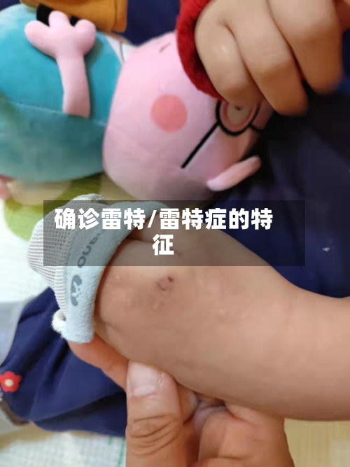 确诊雷特/雷特症的特征