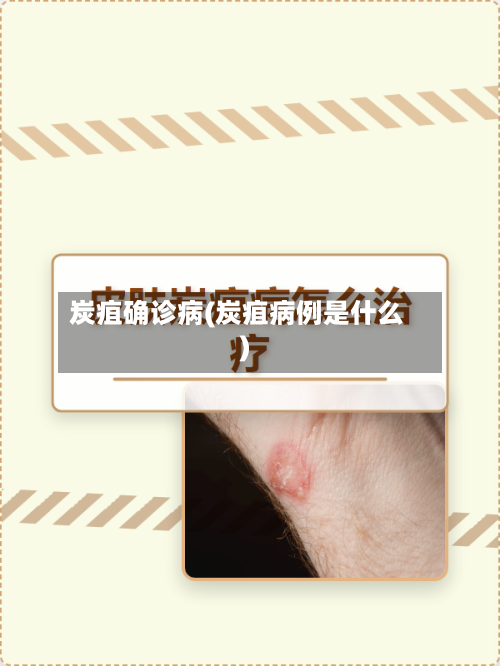 炭疽确诊病(炭疽病例是什么)-第2张图片