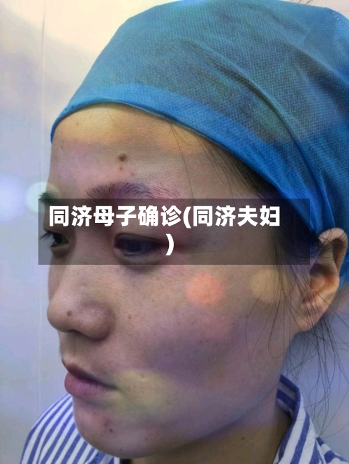 同济母子确诊(同济夫妇)